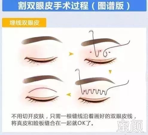 https://img.miyanlife.com/mnt/timg/180827/123S92C9-1.jpg