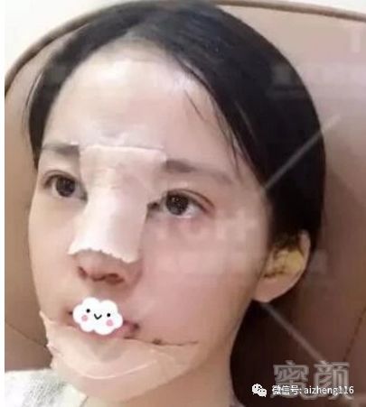 https://img.miyanlife.com/mnt/timg/180828/1101261S1-2.jpg