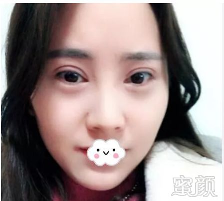 https://img.miyanlife.com/mnt/timg/180828/1134392R2-2.jpg
