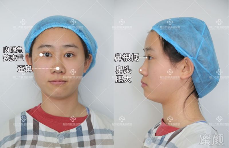 https://img.miyanlife.com/mnt/timg/180828/11491115Z-1.jpg