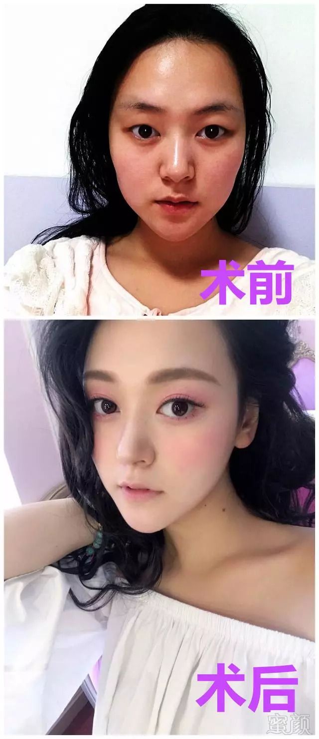 https://img.miyanlife.com/mnt/timg/180828/1149124224-0.jpg