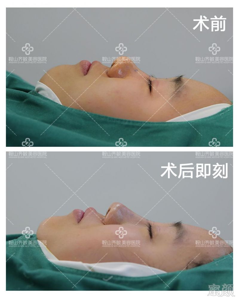 https://img.miyanlife.com/mnt/timg/180828/11491Q215-4.jpg