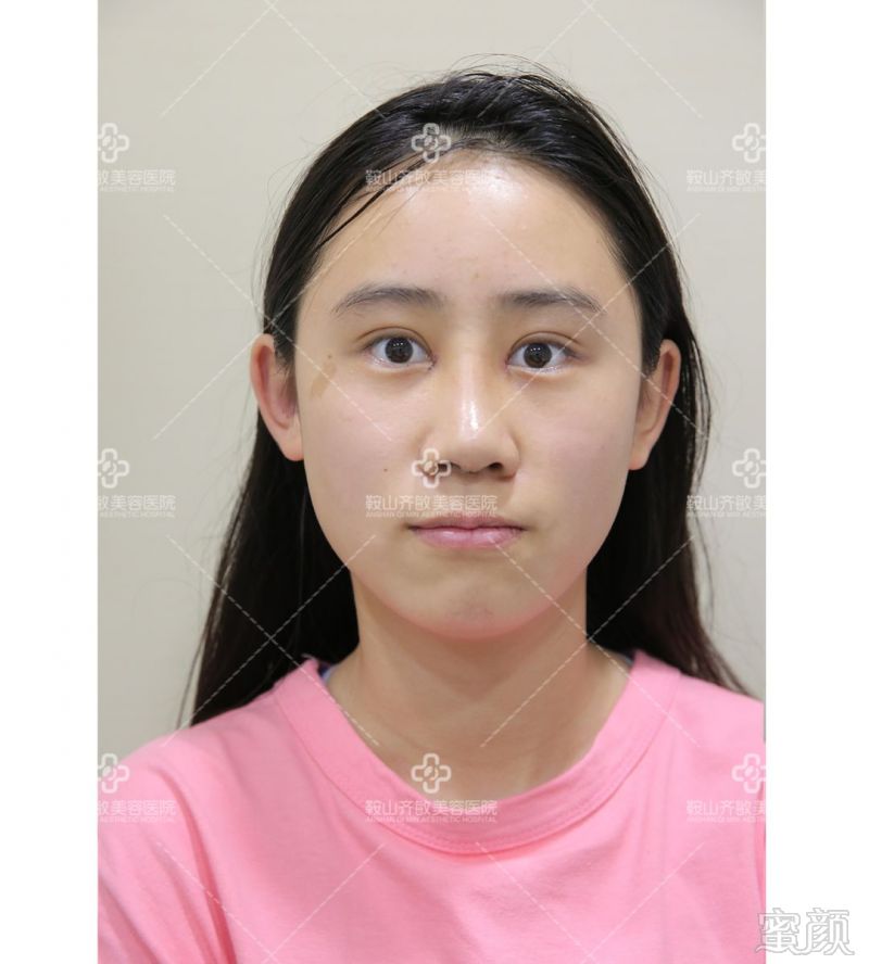 https://img.miyanlife.com/mnt/timg/180828/11491aK4-5.jpg