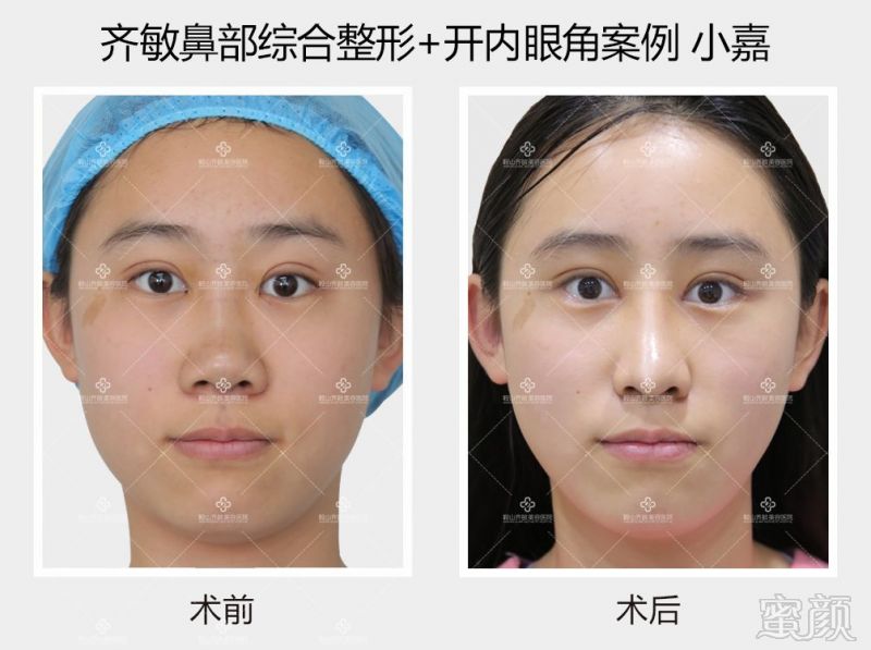 https://img.miyanlife.com/mnt/timg/180828/1149221440-8.jpg