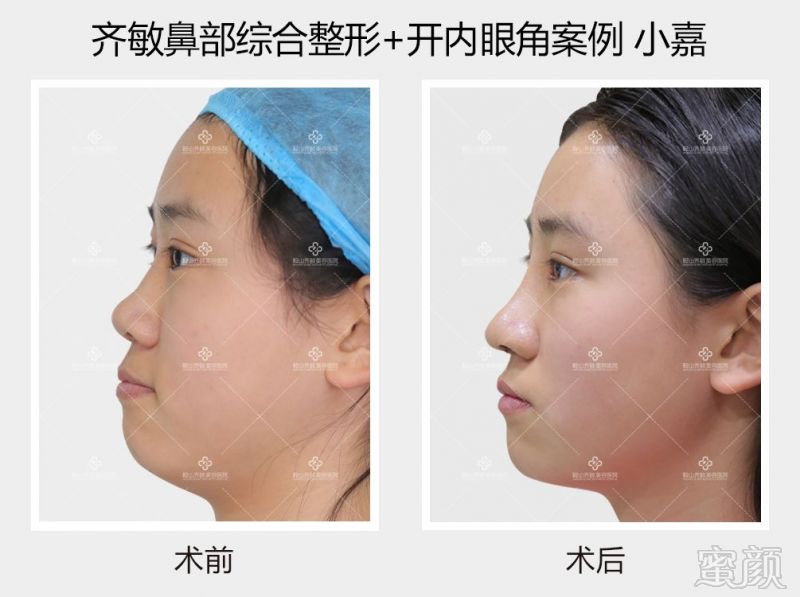 https://img.miyanlife.com/mnt/timg/180828/114922K01-9.jpg