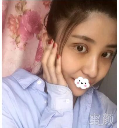 https://img.miyanlife.com/mnt/timg/180828/115022E19-1.jpg