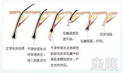 https://img.miyanlife.com/mnt/timg/180828/1200046217-13.jpg