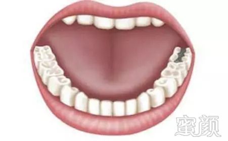 https://img.miyanlife.com/mnt/timg/180828/120I03232-2.jpg