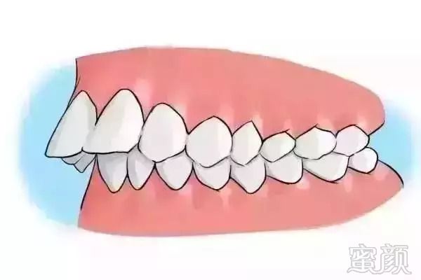https://img.miyanlife.com/mnt/timg/180828/120I15V1-4.jpg