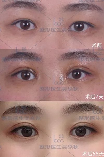 https://img.miyanlife.com/mnt/timg/180828/1210242335-1.jpg