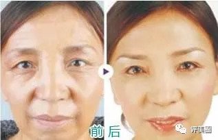 https://img.miyanlife.com/mnt/timg/180828/12105L3P-1.jpg