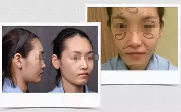 https://img.miyanlife.com/mnt/timg/180828/1211392010-1.jpg