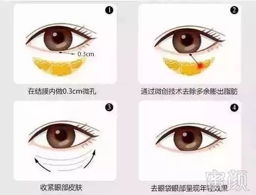 https://img.miyanlife.com/mnt/timg/180828/1212423933-5.jpg