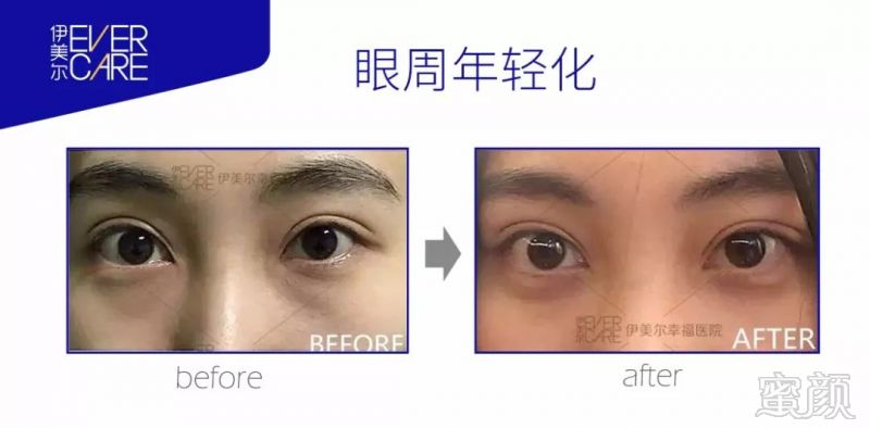 https://img.miyanlife.com/mnt/timg/180828/12152HZ8-3.jpg