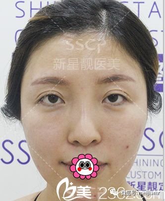 https://img.miyanlife.com/mnt/timg/180828/12200241c-0.jpg