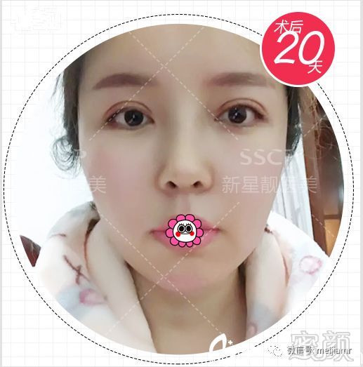 https://img.miyanlife.com/mnt/timg/180828/12200341F-3.jpg