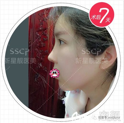 https://img.miyanlife.com/mnt/timg/180828/122003N22-2.jpg