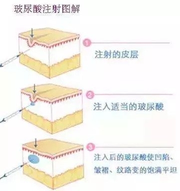 https://img.miyanlife.com/mnt/timg/180828/12220611M-2.jpg