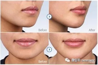 https://img.miyanlife.com/mnt/timg/180828/1222103b1-5.jpg