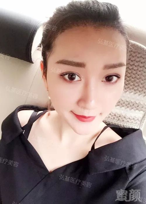 https://img.miyanlife.com/mnt/timg/180828/12245G028-5.jpg