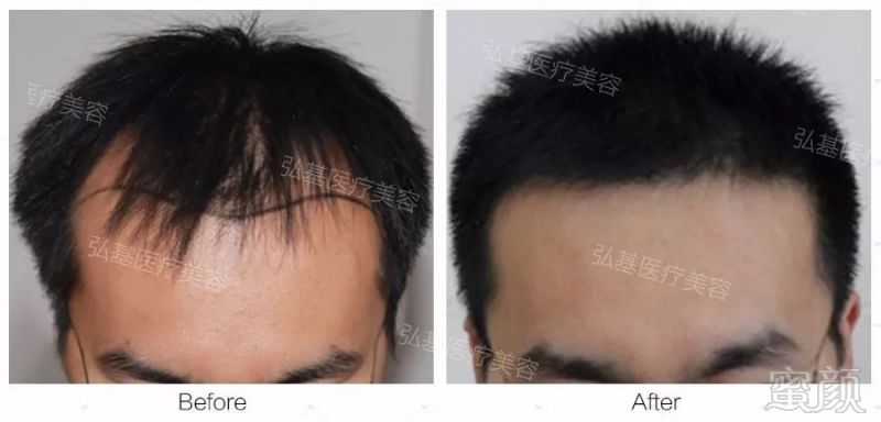 https://img.miyanlife.com/mnt/timg/180828/1225062507-11.jpg