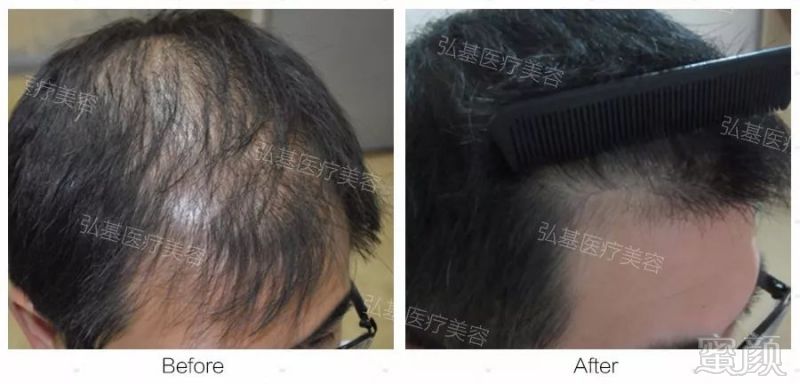https://img.miyanlife.com/mnt/timg/180828/12250M548-12.jpg
