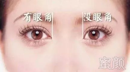 https://img.miyanlife.com/mnt/timg/180828/1230311G9-1.jpg