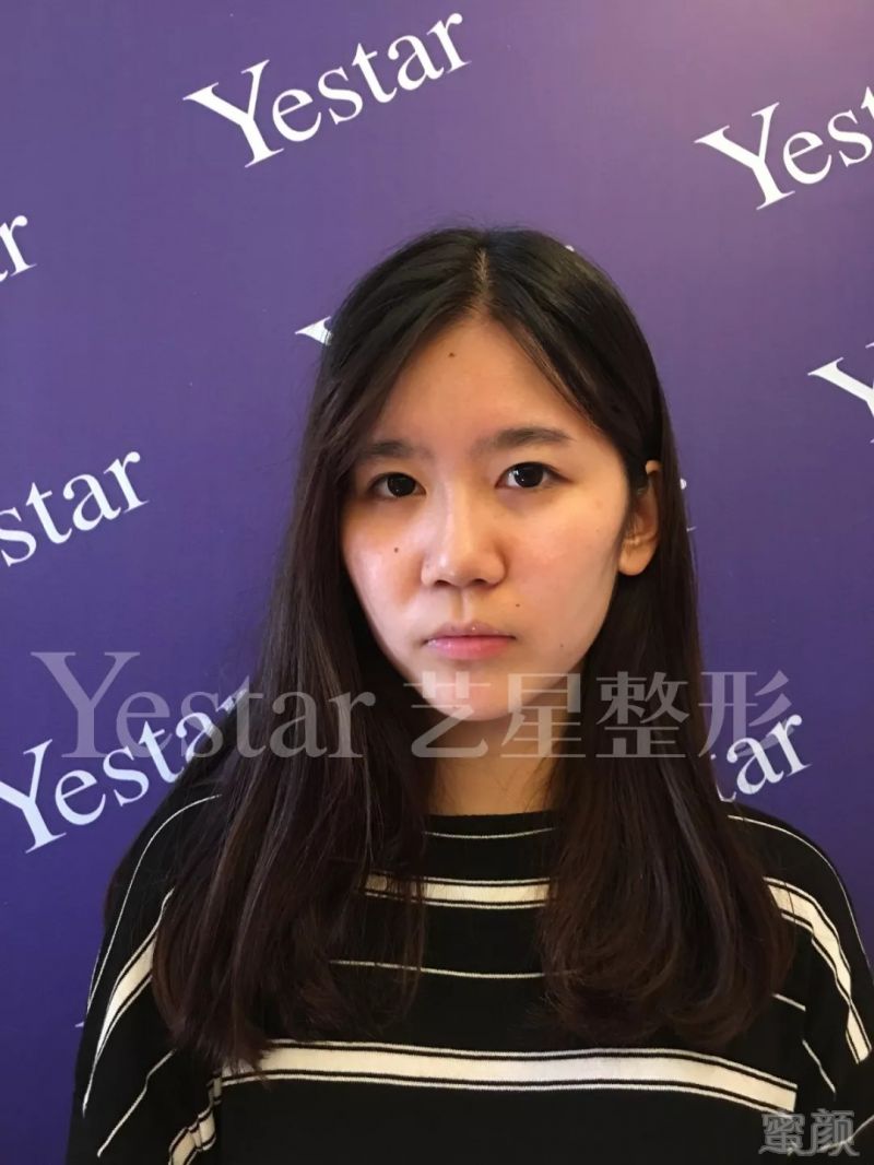 https://img.miyanlife.com/mnt/timg/180828/123G24T2-9.jpg