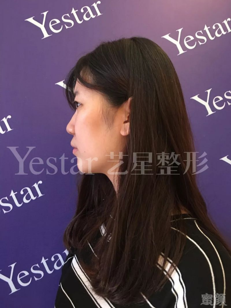 https://img.miyanlife.com/mnt/timg/180828/123G32342-10.jpg