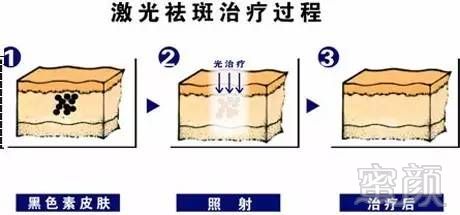 案例图片