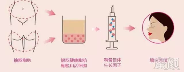 https://img.miyanlife.com/mnt/timg/180828/13133330T-2.jpg