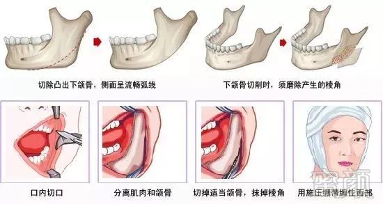 https://img.miyanlife.com/mnt/timg/180829/103A61357-10.jpg