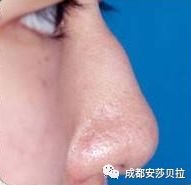 https://img.miyanlife.com/mnt/timg/180829/104QBA6-11.jpg