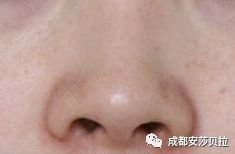 https://img.miyanlife.com/mnt/timg/180829/104QBa7-14.jpg
