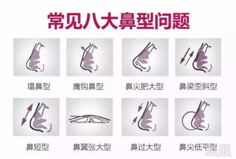 https://img.miyanlife.com/mnt/timg/180829/1121194545-0.jpg
