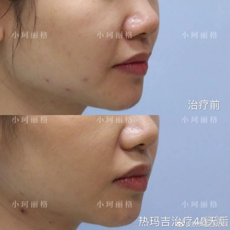 https://img.miyanlife.com/mnt/timg/180829/112T04237-2.jpg