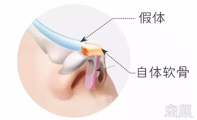 https://img.miyanlife.com/mnt/timg/180829/113I32041-7.jpg