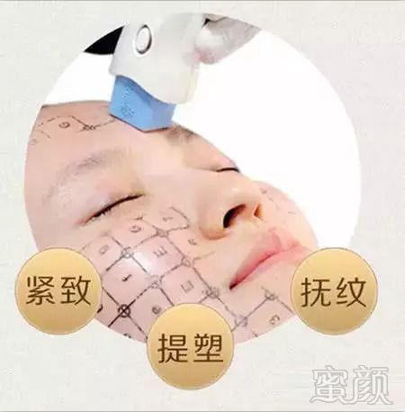 https://img.miyanlife.com/mnt/timg/180829/11424454S-7.jpg