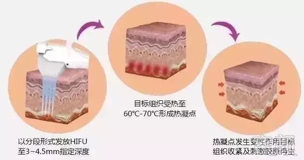 https://img.miyanlife.com/mnt/timg/180829/11424J561-10.jpg