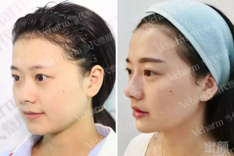https://img.miyanlife.com/mnt/timg/180829/115639BI-7.jpg