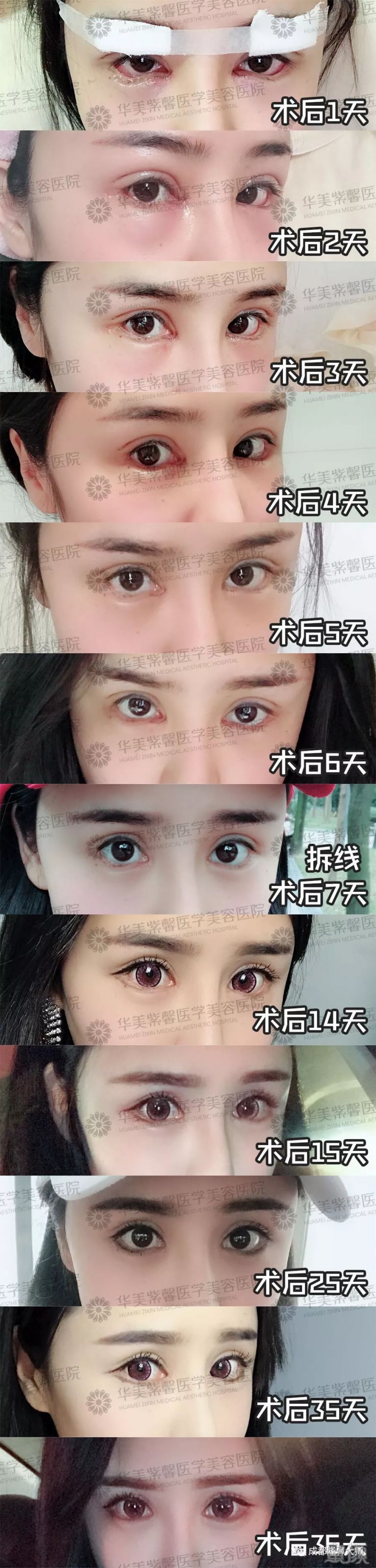 https://img.miyanlife.com/mnt/timg/180829/115I4H16-10.jpg