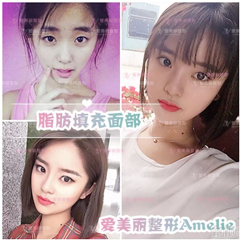 https://img.miyanlife.com/mnt/timg/180829/1200014093-5.jpg