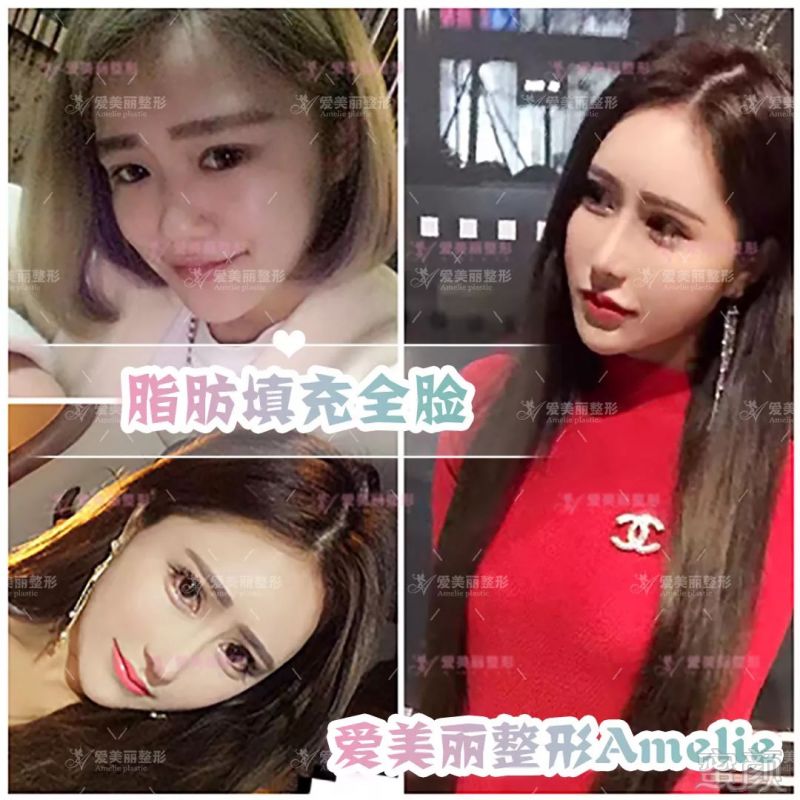 https://img.miyanlife.com/mnt/timg/180829/1200025b1-6.jpg