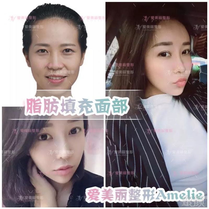 https://img.miyanlife.com/mnt/timg/180829/12000344G-7.jpg