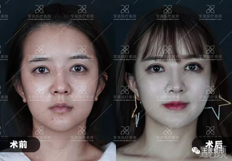 https://img.miyanlife.com/mnt/timg/180829/1200123U2-2.jpg