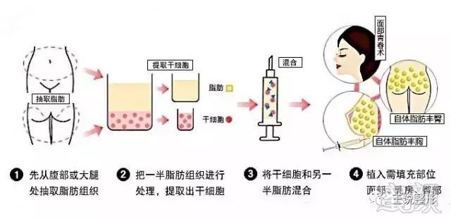 https://img.miyanlife.com/mnt/timg/180829/12001244M-0.jpg