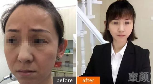 https://img.miyanlife.com/mnt/timg/180829/120150L93-5.jpg