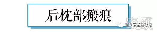 https://img.miyanlife.com/mnt/timg/180829/12162K940-3.jpg