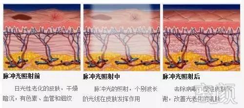 案例图片