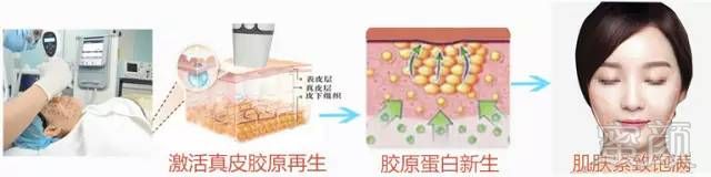 https://img.miyanlife.com/mnt/timg/180830/1039403060-3.jpg